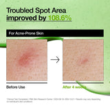 Serum Anua Ac Azelaico 10%