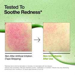 Serum Anua Ac Azelaico 10%